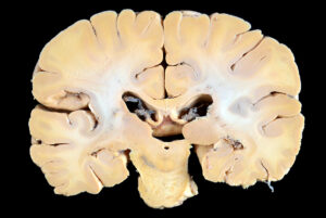 Corte Coronal (16)